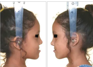 Figure 1  - Patient who obtained the lowest score (2.8).