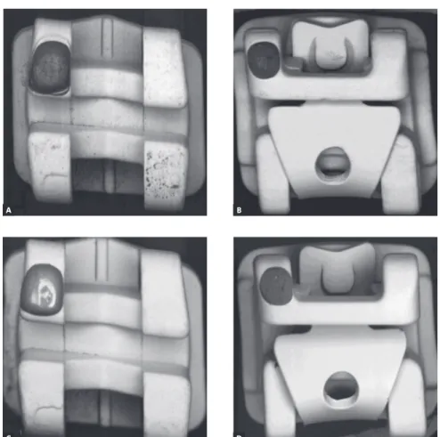 Figure 1  - Top view of the brackets surfaces: 