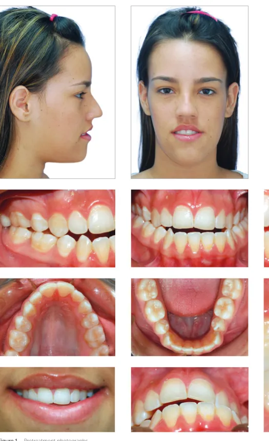 Figure 1  - Pretreatment photographs.