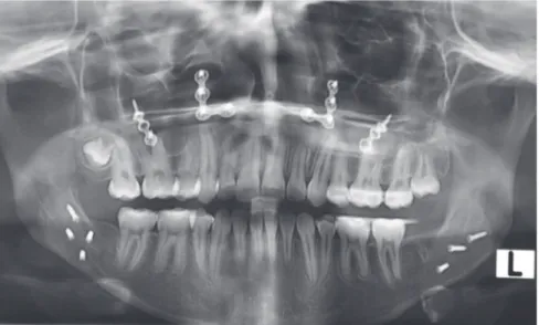 Figure 8 - Final dental casts.