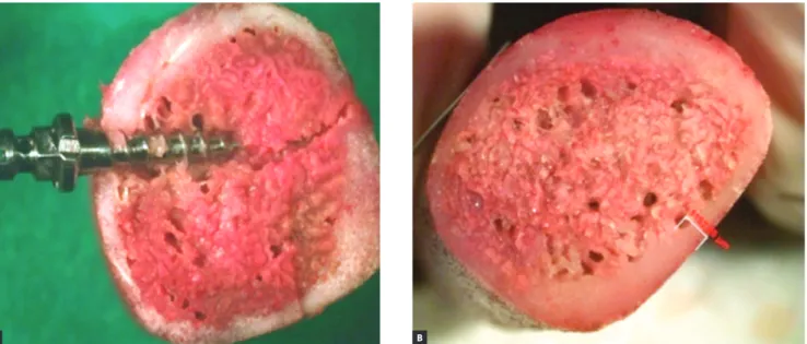 Figure 4 - Mini-implant position in pork rib (A) and cortical bone thickness of pork rib block used in the insertion test of mini-implants (B).