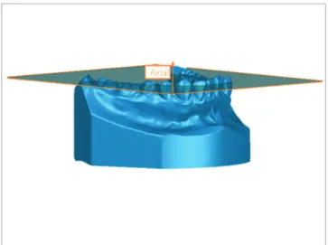 Figure 1 - Axial plane.