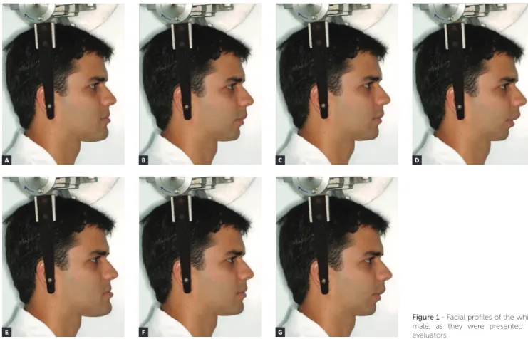 Figure 1 - Facial profiles of the white  male, as they were presented to  evaluators.