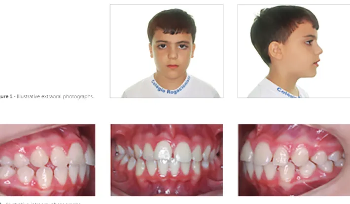 Figure 1 - Illustrative extraoral photographs.