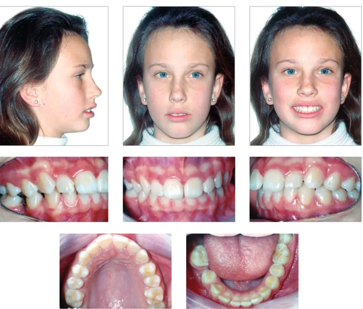 Figure 1 - Initial facial and intraoral photographs.