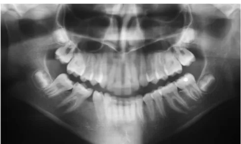 Figure 3 - Initial panoramic radiograph.