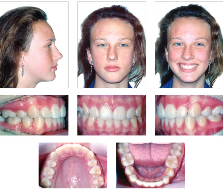 Figure 6 - Final facial and intraoral photographs. 