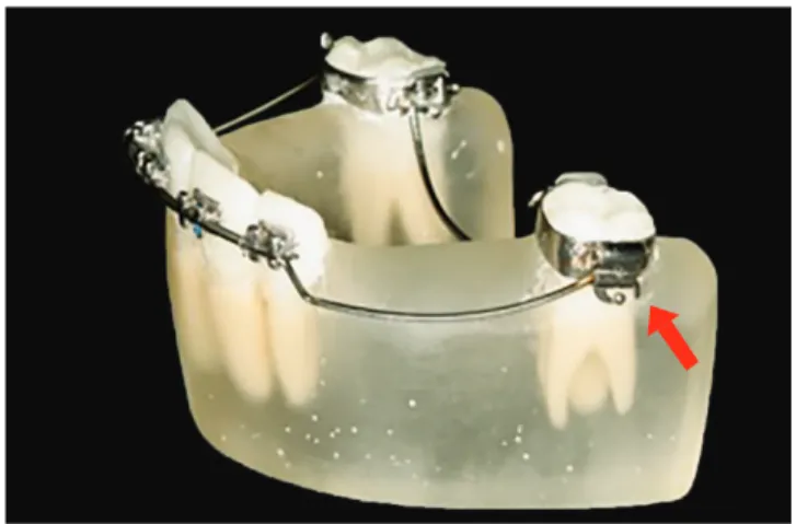 Figure 5 - Crystal model base (2 mm) for fixation and stabilization of photo- photo-elastic models.
