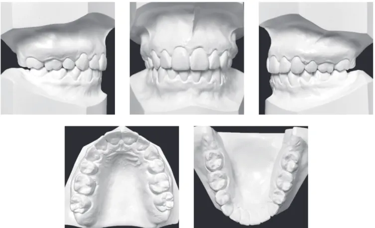Figure 8 - Final dental casts.