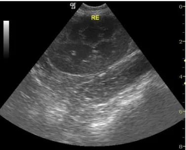 Figura  3:  Imagem  ultra-sonográfica  do  rim  esquedo  do  Preto.  Pode-se  observar  a  perda  da  diferenciação cortico-medular