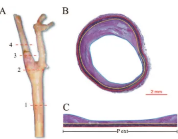 Figure 2. (A) Right carotid artery and the site of 4 cross-sections: 