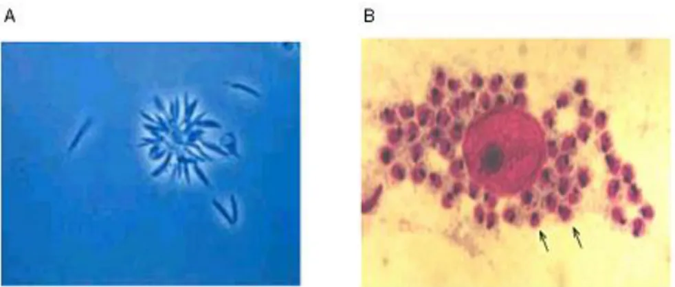 Figura 2 - Formas evolutivas de Leishmania spp. Promastigota (A) e Amastigota (B). (FonteA: 
