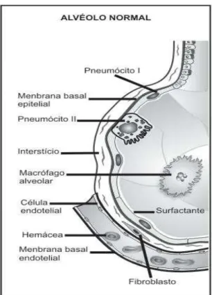 Figura 1 - Membrana alvéolo-capilar normal formada por surfactante, pneumócitos I, membrana basal  epitelial,  interstício,  membrana  basal  endotelial,  e  endotélio  capilar