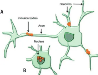 Figure 1. Aggregate formation by HTT mutation in neuron cell derives  inclusion bodies: [A] Inclusion body accumulation at axons and dendrites  (cytoplasm); and [B] nucleus