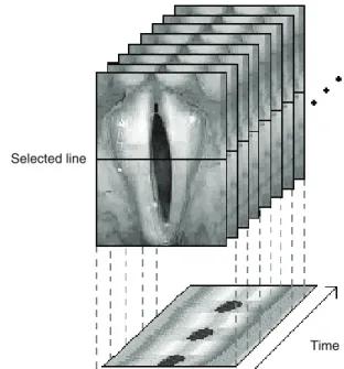 Figure 1. Schematic design representing the generation of a kymograph. 