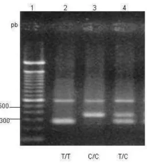 Figura  2.  Gel  de  agarose  dos  produtos  amplificados  do  gene  IL1B  na  posição  -31  (PCR- (PCR-CTPP)
