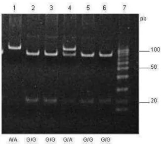 Figura  4.  Gel  de  acrilamida  dos  produtos  amplificados  do  gene  TNFA  (PCR-RFLP)