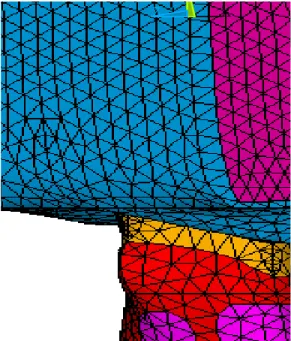 Figura 10 – Restauração das cavidades interproximais  extensa, conservadora e de acesso endodôntico  Modelo 9  
