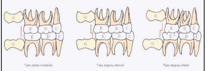 FIGURA 9 – Relação dos segundos molares. 