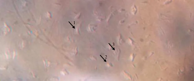 Figura 2. Análise morfológica plaquetária em formolsalina avaliada por microscopia óptica de inversão de fase