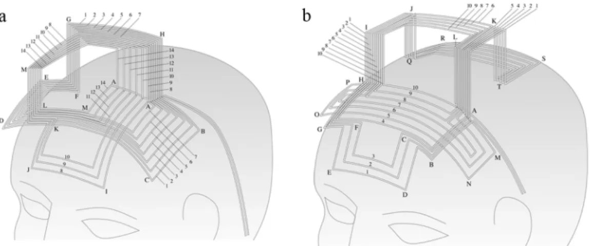 Figure 2.1.2: Geometry of H1 (a) and H2 (b) coils. The coils have the same design principles but were  designed to stimulate different target regions: left prefrontal cortex for the H1 coil and medial  orbitofrontal cortex for the H2 coil