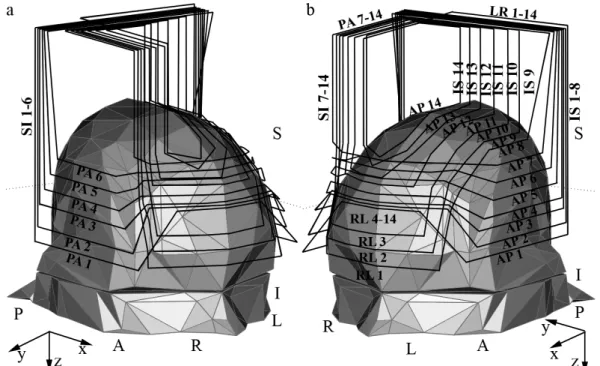 Figure 2.3.1.1: A model of the H1 coil placed over a realistically shaped homogeneous head model