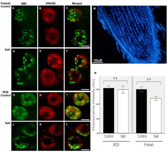 Figure  2:  3D  imaging  of  DNA  methylation  in  single  interphase  nuclei. 