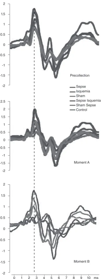 Figure 1. Layout of the average of the potential of the auditory  brainstem response in each study group in all the moments  (precollection, A, and B)21.510.50-0.5-1-1.5-221.510.50-0.5-1-1.5-22.521.510.50-0.5-1-1.5-2 PrecollectionSepse IsquemiaSham Sepse I