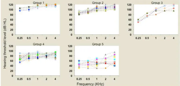 Figure 1. Individual audiometric curves (dB HL) according to frequency (kHz) for groups (Gr1, Gr2, Gr3, Gr4 and Gr5)