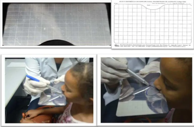 Figure 1. Altmann graph mirror, record sheet, and nasal aeration marking