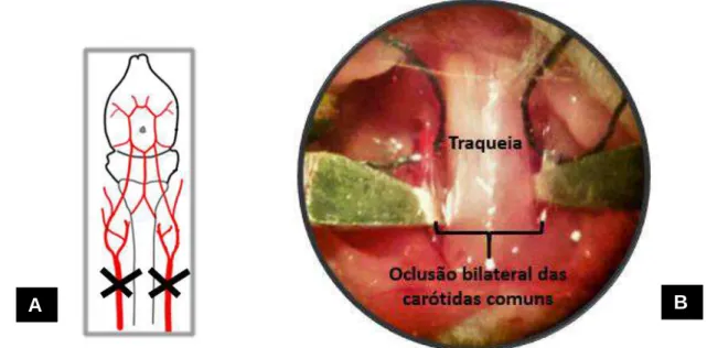 Figura  4.  Anatomia  vascular  cerebral  de  camundongos  (vista  ventral)  e  representação  da  oclusão  das 