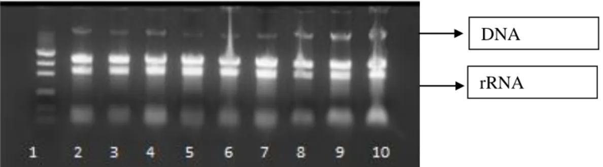 Figura 11: Comparação da integridade das amostras de RNA total do A. terreus BLU24, extraído  de acordo com o protocolo de Brasileiro &amp; Carneiro (1998)