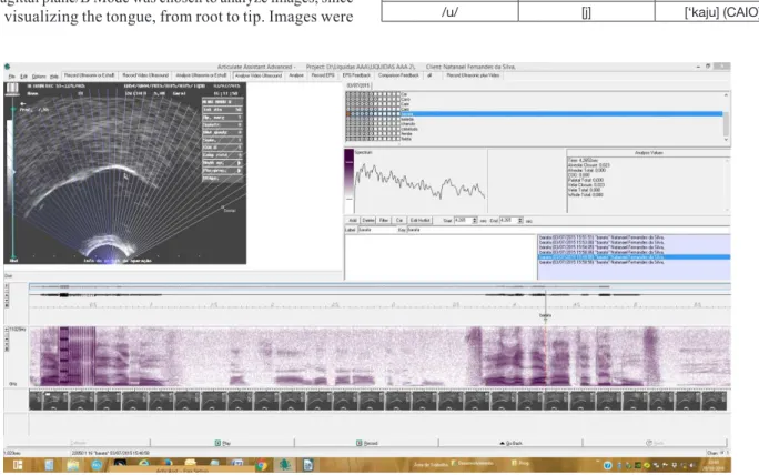 Figure 1. Previous selection of the angle for analysis of the images - 120 degree angle - selection of the anterior area of the tongue (dental) to  the right of the video