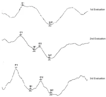 Figure 1. Representation of the analysis of the PEALL obtained from  one of the children during the three moments of evaluation