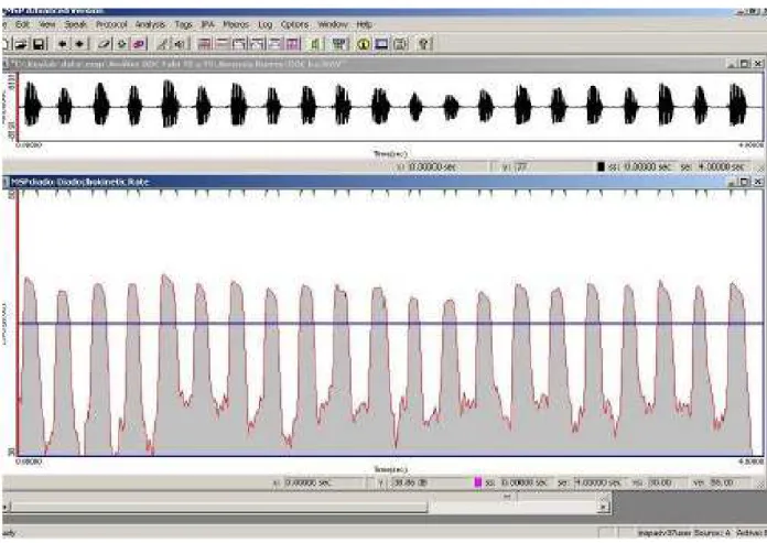 Figura 1. Gráfico do programa Motor Speech Profile Advanced modelo 5141, versão 252 da KayPentax no qual se observa o tempo (segundos)  no eixo horizontal e a energia (dB) no eixo vertical a linha horizontal de análise da DDC