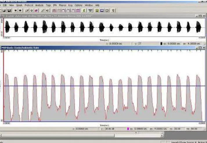 Figure 1. Graphic of program Motor Speech Profile Advanced model 5141, version 252, by KayPentax in which the time (in seconds) is observed  on the horizontal axis, and energy (dB) on the vertical axis, the horizontal line of DDK analysis