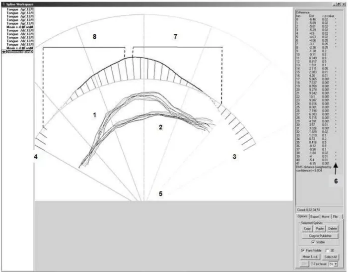 Table 1 presents descriptive values of each acoustic parameter  for adults and children with TSD.
