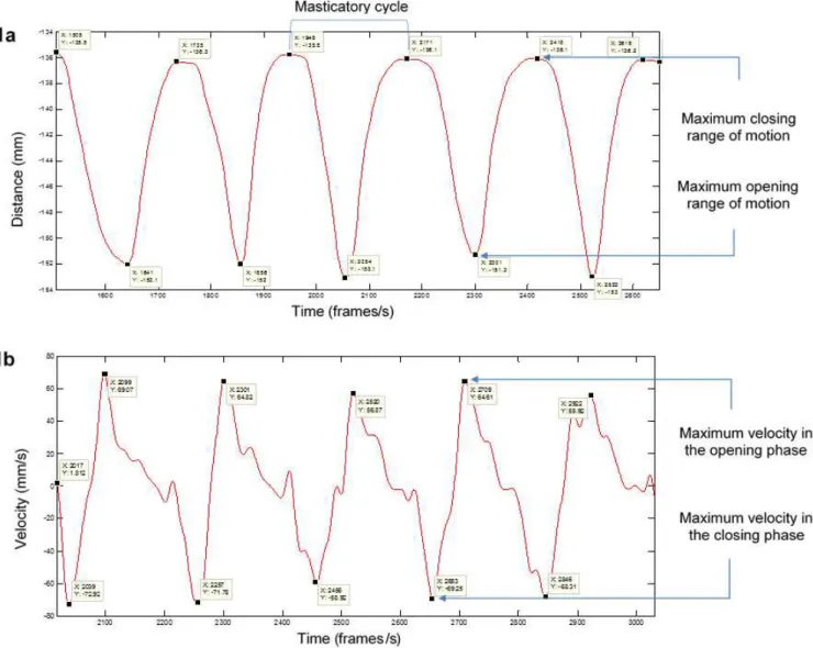 Figure 1. Graphic representation of vertical mandibular range of motion and velocity during chewing