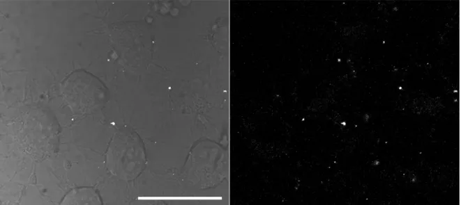 Figura 9: Interação da STI-1 AF568 com células SN56. As células foram incubadas  com 1  μ M de STI-1 AF568, durante 40 minutos a 4 °C e analisadas por microscopia  confocal