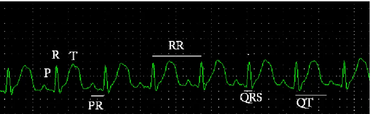 Figura 8 – Eletrocardiografia computadorizada feita em um coelho do grupo controle. Observar as ondas 