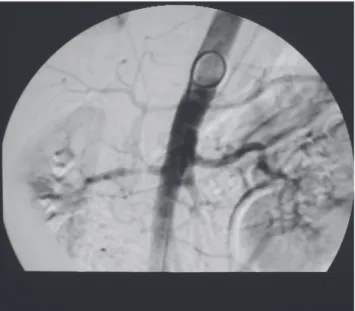 Figure 1 - Reported patient, now aged 18. Patient has given written authorization for the publication of this picture.