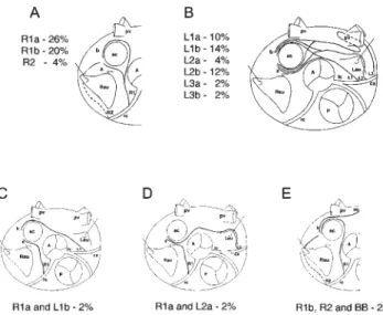 Figure 1 - Schematic representation of the route types of the sinuatrial node branch (NB) and its frequency