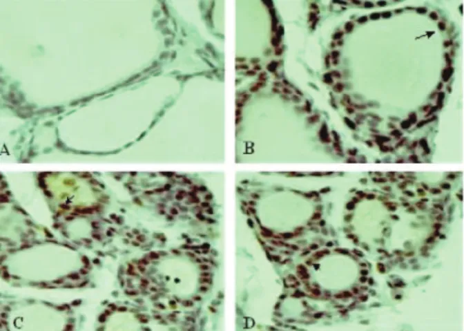 Figure 2- Photomicrograph of PCNA reaction in the central area of the right thyroid lobe of ovariectomized rats: A