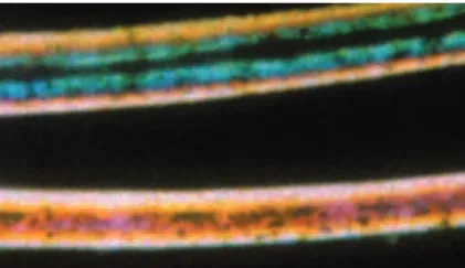 Figure 5 - CHS: hair under polarized light microscopy, bright shafts of different colors (x40).