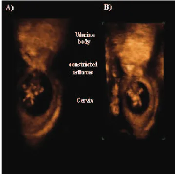 Figure 2. Multiplanar imaging with the three orthogonal sections: a) sagittal section, b) transversal section, c) coronal section, and d) reconstructed  three-dimensional image