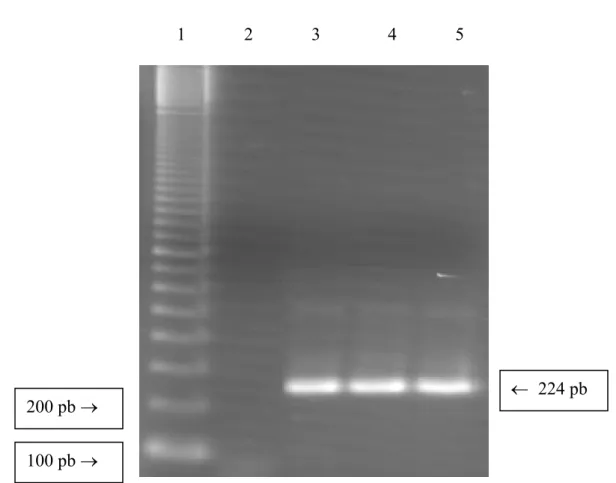 FIGURA 3 -  Reação da PCR para detecção do HCMV, visualização dos resultados em gel de  agarose