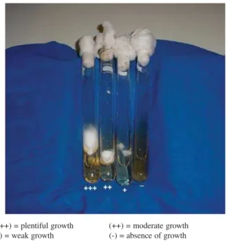 Table 2 - Growth index of 31 isolates of dermatophytes sown in Sabouraud-dextrose broth at 30°C in the presence of different concentrations of urea
