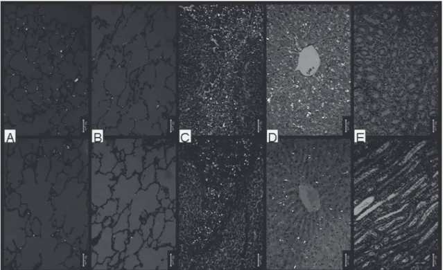Figure 3 - Photomicrographs of the left (A) and right lung (B), spleen (C), liver (D), and kidney (E) of rabbits submitted to th intrapleural instillation of small-particle talc (< 5 µm) (upper panel) and mixed talc (90% of particles > 10 µm) (lower 