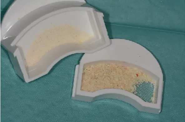 Figura 4 – Compartimentos inferior (à esquerda) e superior (à direita) do equipamento “Smart Dentin  Grinder ® ”