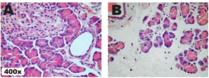 Figure 2. Micrography of pancreas histology of: Group I (A; minimal edema) and Group II (B; pronounced edema) rats
